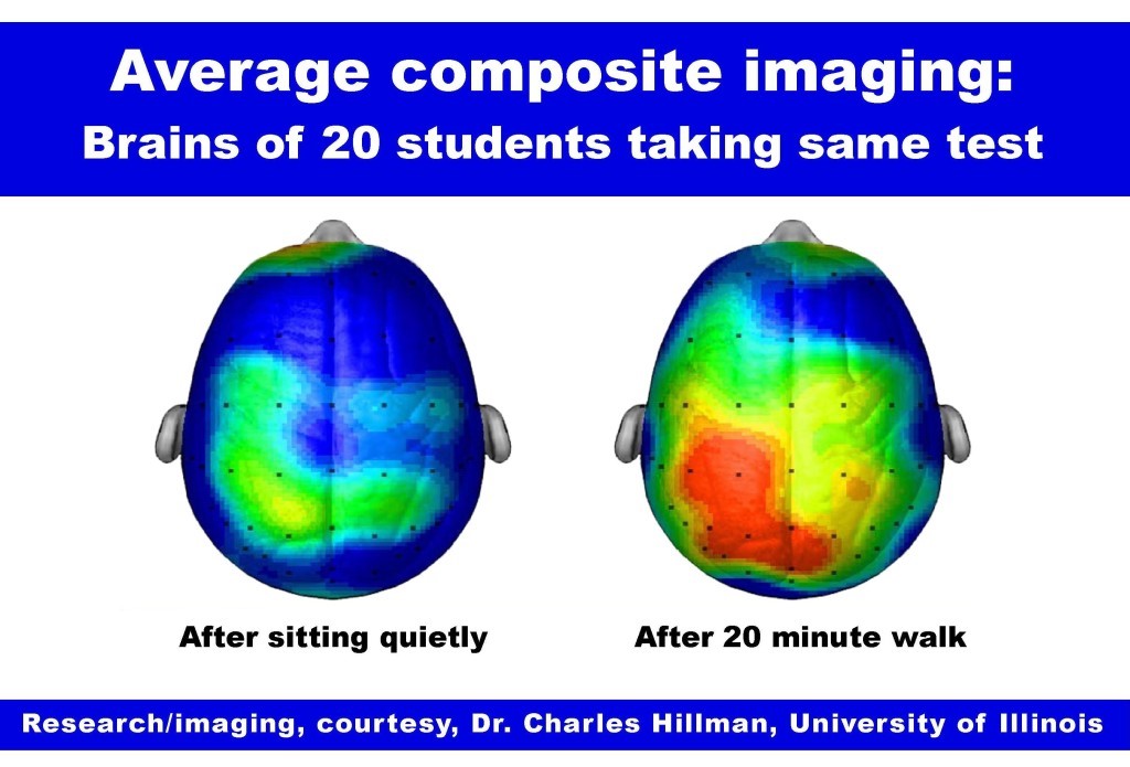 Brain.jpg